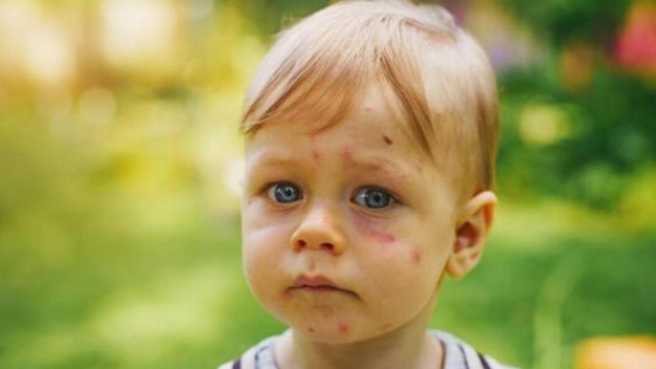 Meteoroloji açıkladı: Cuma ve cumartesi Türkiye'ye giriş yapıyor! Alerjisi olanları yakından ilgilendiriyor