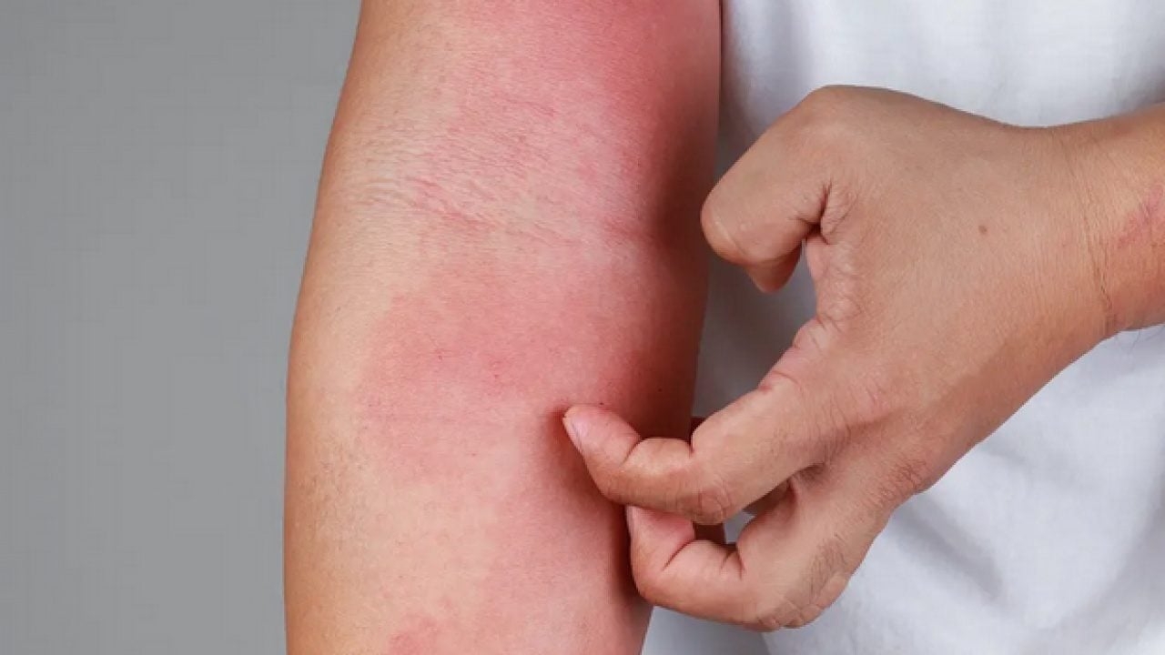 Foto - D vitamini konusunda uzman isim uyardı: Bu vitaminin eksikliği cilt sağlığını bozuyor olabilir