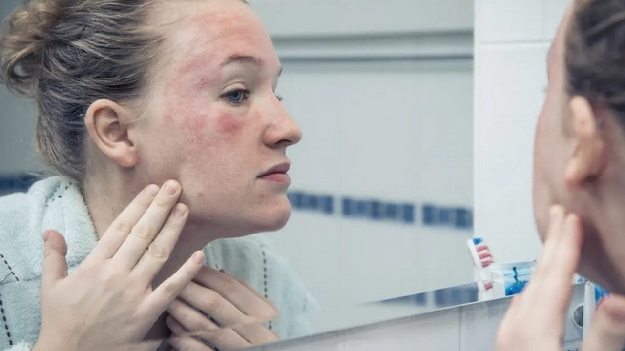 Foto - D vitamini konusunda uzman isim uyardı: Bu vitaminin eksikliği cilt sağlığını bozuyor olabilir