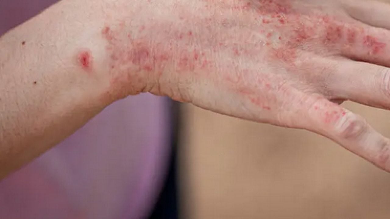 Foto - D vitamini konusunda uzman isim uyardı: Bu vitaminin eksikliği cilt sağlığını bozuyor olabilir