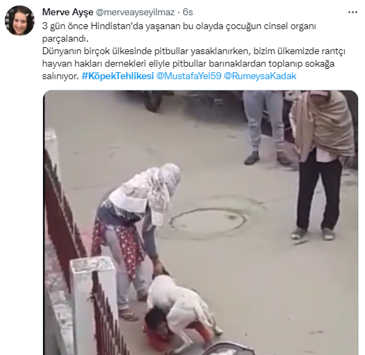 Foto - Daha kaç çocuğun ölmesi gerekiyor bu sorunun çözülmesi için! Köpek tehlikesi kaosa sürüklüyor!
