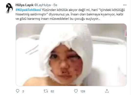 Foto - Daha kaç çocuğun ölmesi gerekiyor bu sorunun çözülmesi için! Köpek tehlikesi kaosa sürüklüyor!