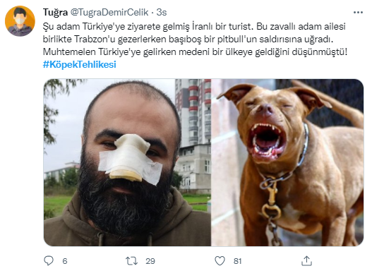 Foto - Daha kaç çocuğun ölmesi gerekiyor bu sorunun çözülmesi için! Köpek tehlikesi kaosa sürüklüyor!
