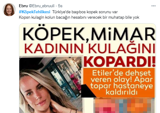 Foto - Daha kaç çocuğun ölmesi gerekiyor bu sorunun çözülmesi için! Köpek tehlikesi kaosa sürüklüyor!