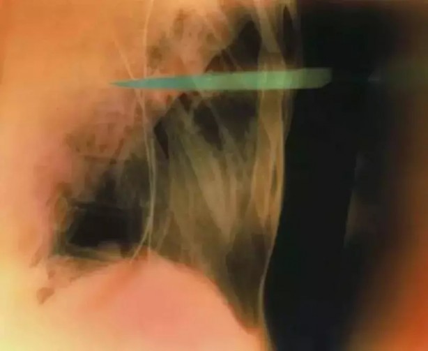 Foto - Daha önce böylesini görmediniz! Bu görüntüler herkesi dehşete düşürüyor