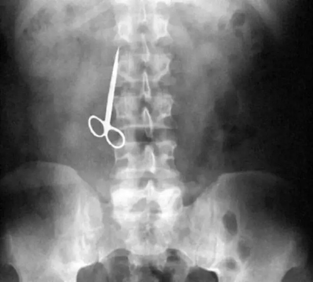 Foto - Daha önce böylesini görmediniz! Bu görüntüler herkesi dehşete düşürüyor