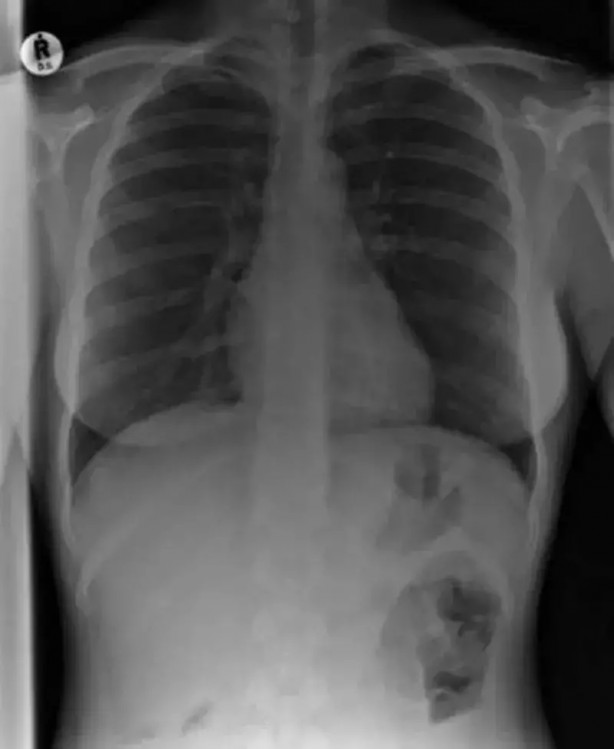 Foto - Daha önce böylesini görmediniz! Bu görüntüler herkesi dehşete düşürüyor