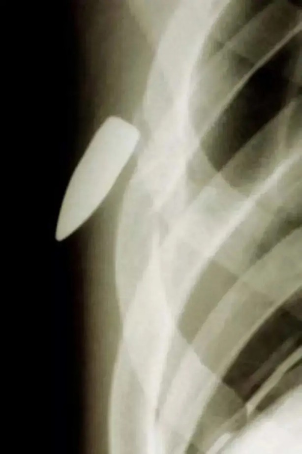 Foto - Daha önce böylesini görmediniz! Bu görüntüler herkesi dehşete düşürüyor