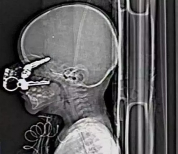 Foto - Daha önce böylesini görmediniz! Bu görüntüler herkesi dehşete düşürüyor