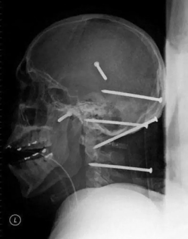 Foto - Daha önce böylesini görmediniz! Bu görüntüler herkesi dehşete düşürüyor