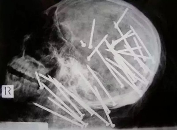 Foto - Daha önce böylesini görmediniz! Bu görüntüler herkesi dehşete düşürüyor