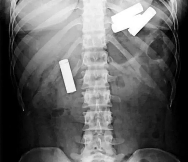 Foto - Daha önce böylesini görmediniz! Bu görüntüler herkesi dehşete düşürüyor