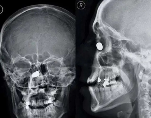 Foto - Daha önce böylesini görmediniz! Bu görüntüler herkesi dehşete düşürüyor