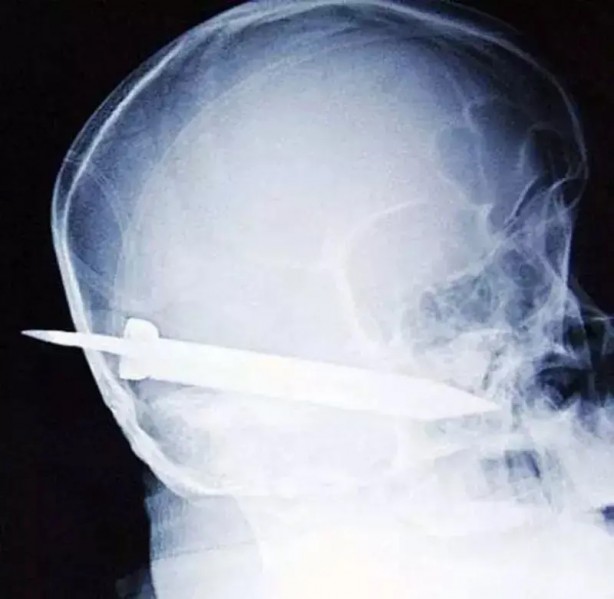 Foto - Daha önce böylesini görmediniz! Bu görüntüler herkesi dehşete düşürüyor