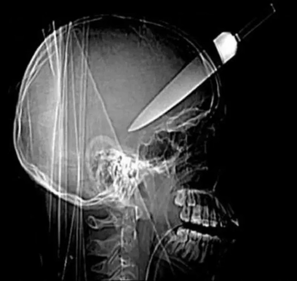 Foto - Daha önce böylesini görmediniz! Bu görüntüler herkesi dehşete düşürüyor