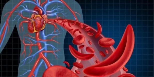 Damar tıkanıklığına iyi gelen 5 besin! Damarları açan, güçlendiren besinler