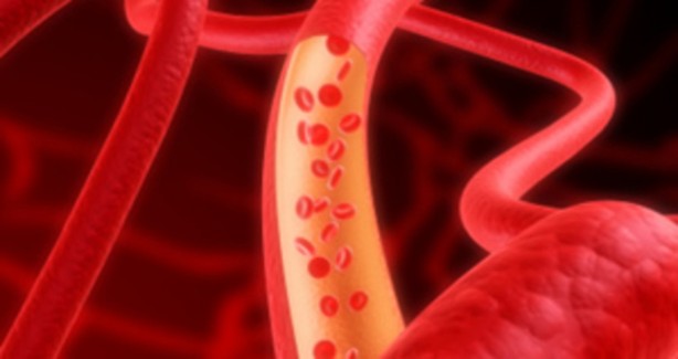 Foto - Damar tıkanıklığına iyi gelen besinler