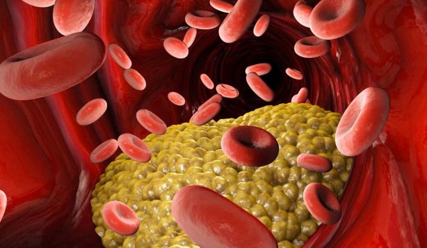 Foto - Damarları sağlıklı tutmanın 4 yolu