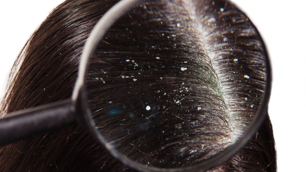 Foto - Defne yaprağını yakıp 10 dakika bekleyince çok şaşıracaksınız: Uygulanan 11 alışkanlık! Akdeniz’in gizli şifa kaynağı!