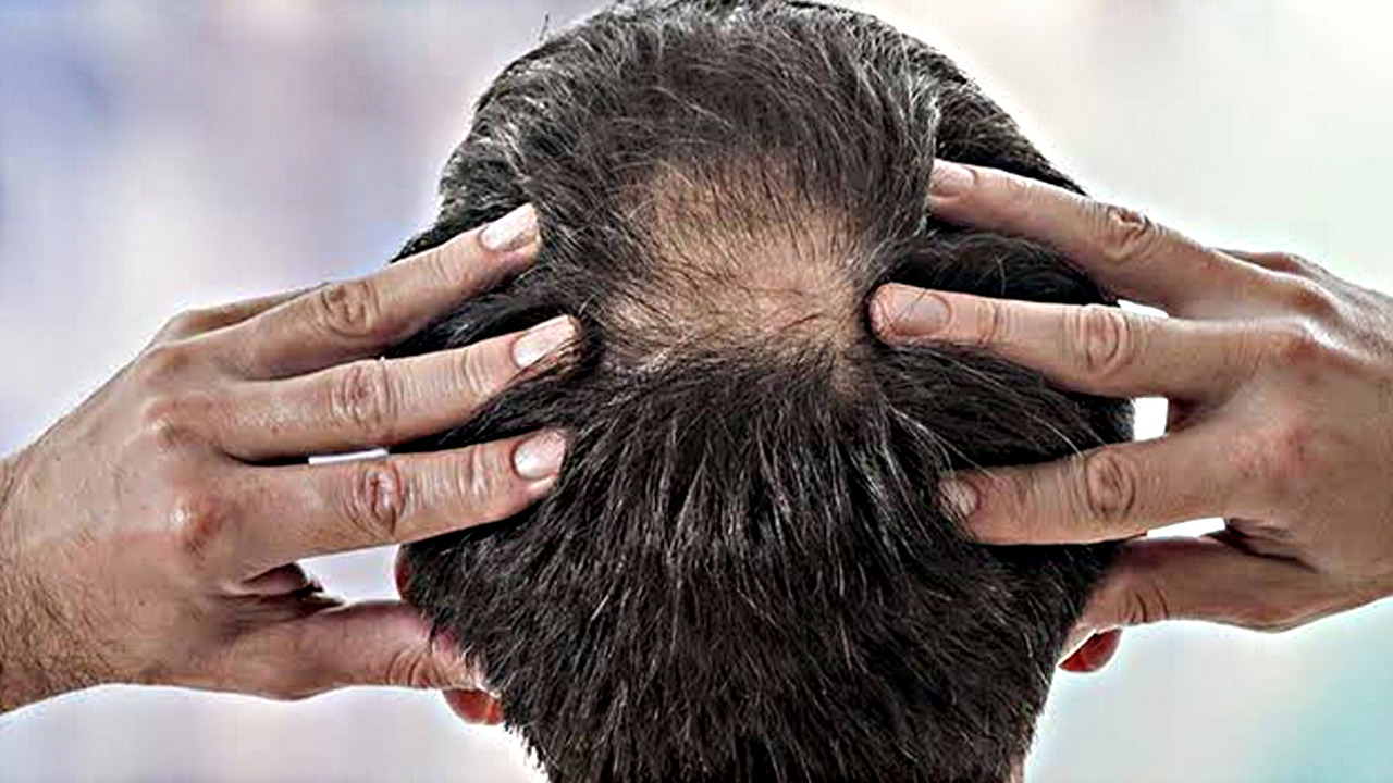 Demir eksikliğinin 12 önemli belirtisi nelerdir? Demir üretimini hızlandırıyor, cilt sağlığını destekliyor!