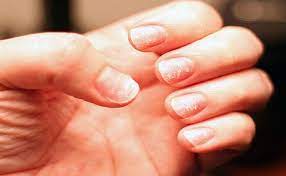 Foto - Demir eksikliğinin belirtileri ve nedenleri! Prof. Dr. İbrahim Saraçoğlu'ndan kansızlık kürü tarifi: Müjde, resmen geçirdi!