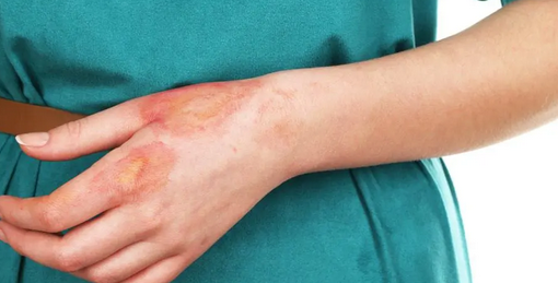 Foto - Demlikte kalan çayı sakın atmayın! Bayat çay şifa dağıtıyor: Faydaları nefes kesti