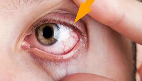 Foto - Demlikte kalan çayı sakın atmayın! Bayat çay şifa dağıtıyor: Faydaları nefes kesti