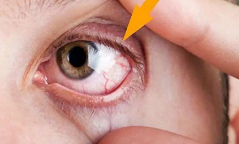 Foto - Demlikte kalan çayı sakın atmayın! Çay tiryakileri aman dikkat: Sadece 10 dakikada yardımcısı! İşte o mesajlar