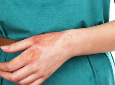 Foto - Demlikte kalan çayı sakın atmayın! Çay tiryakileri aman dikkat: Sadece 10 dakikada yardımcısı! İşte o mesajlar