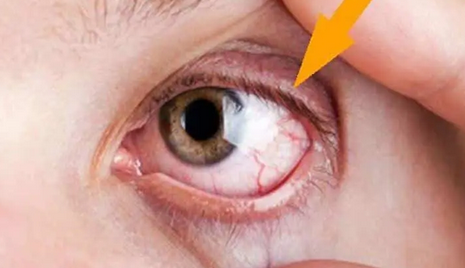 Foto - Demlikte kalan çayı sakın atmayın: en iyi sırrı bu yöntemde saklı! Çay tiryakileri işte böyle deneyiniz