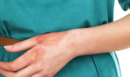 Foto - Demlikte kalan çayı sakın atmayın: en iyi sırrı bu yöntemde saklı! Çay tiryakileri işte böyle deneyiniz