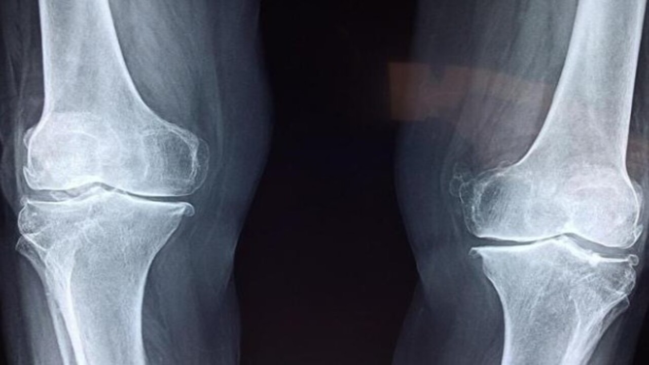 Foto - Deneyenler şaştı kaldı! Eklem ağrısından kurtulmanın yolu bakın neymiş