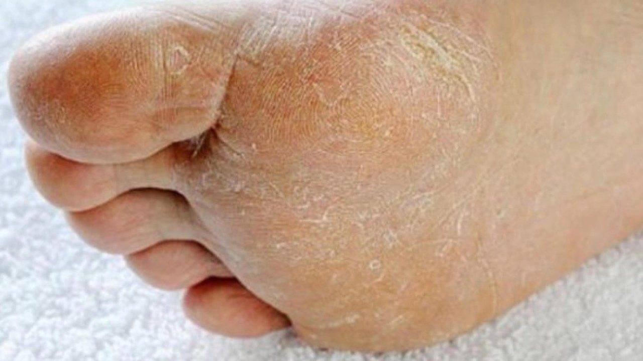 Foto - Deneyince farkını göreceksiniz! Nasır tutmuş topukları pamuk gibi yapmanın sırrı