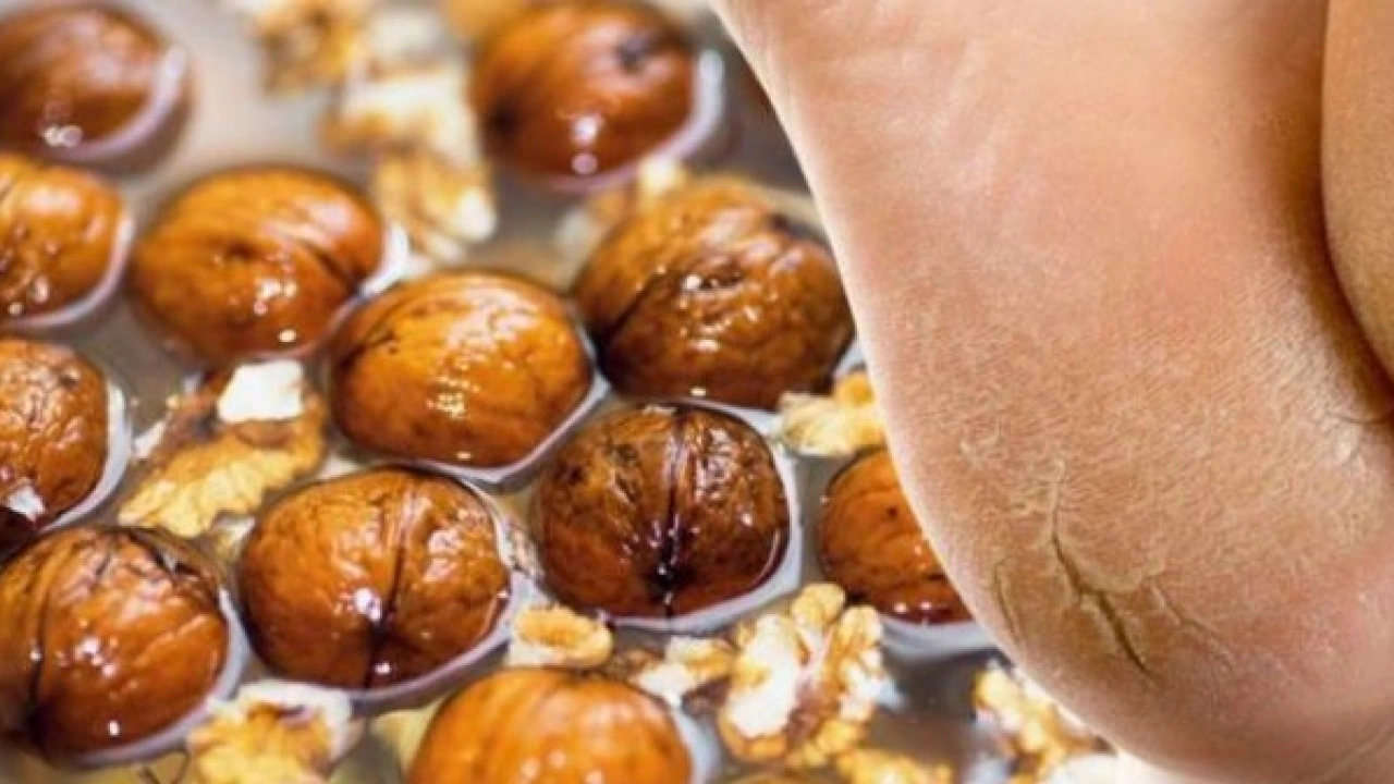 Deneyince farkını göreceksiniz! Nasır tutmuş topukları pamuk gibi yapmanın sırrı