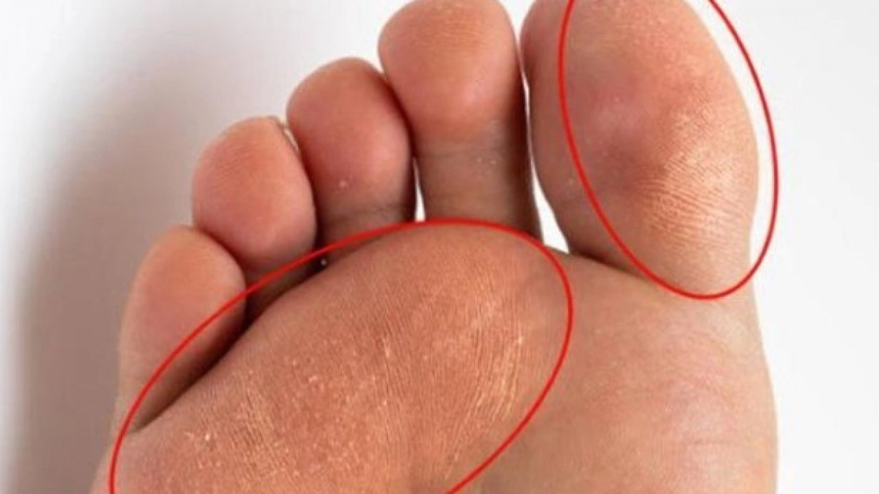 Foto - Deneyince farkını göreceksiniz! Nasır tutmuş topukları pamuk gibi yapmanın sırrı