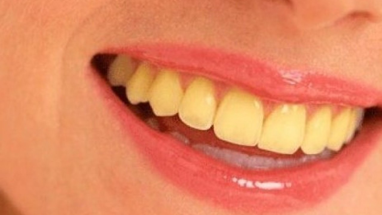 Deneyince farkını göreceksiniz! Sararmış dişleri kar beyazı yapmanın kolay yöntemi