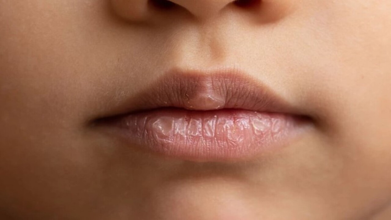 Foto - Deneyince farkını göreceksiniz! Sıcaktan dudakları çatlayanlara doğal çözüm
