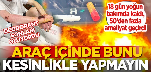 Foto - Deodorant sonları oluyordu: Araç içinde bunu kesinlikle yapmayın
