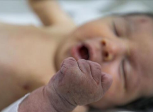 Foto - Deprem enkazından çıkarılmıştı! Dünya bu bebeği istiyor