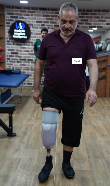 Foto - Depremde ailesini ve bacağını kaybetti! Yine de hayata tutundu