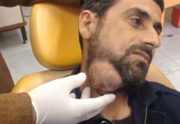 Foto - Dev kitleye neşter vurdular!