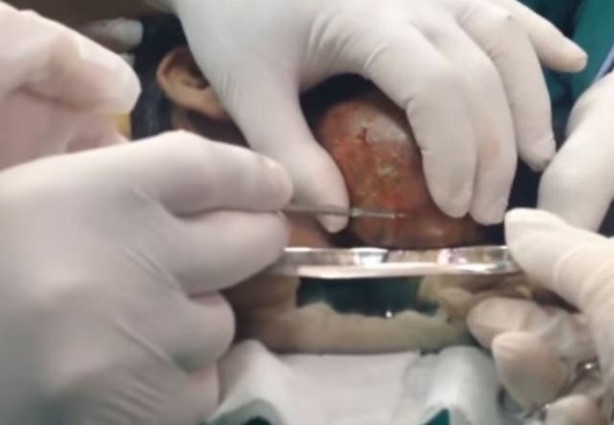 Foto - Dev kitleye neşter vurdular!