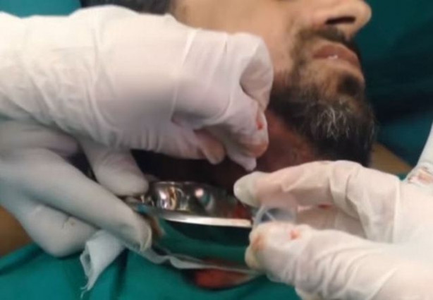 Foto - Dev kitleye neşter vurdular!