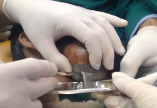 Foto - Dev kitleye neşter vurdular!