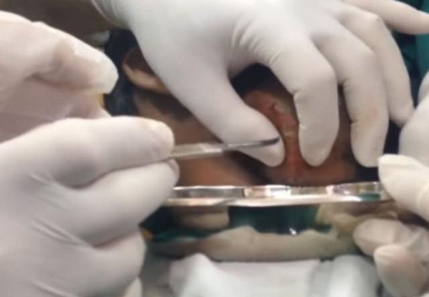 Foto - Dev kitleye neşter vurdular!