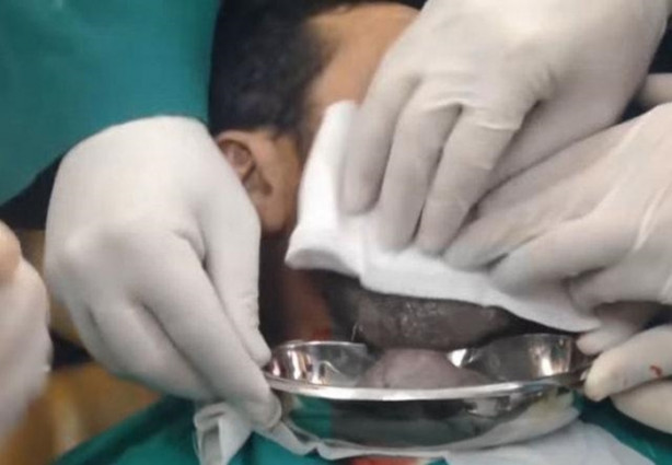 Foto - Dev kitleye neşter vurdular!