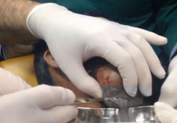 Foto - Dev kitleye neşter vurdular!