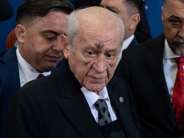 Devlet Bahçeli’nin yüzündeki morluklar çok konuşulmuştu! Seçimlerin ardından flaş iddia geldi! Bu gerçekten doğru mu