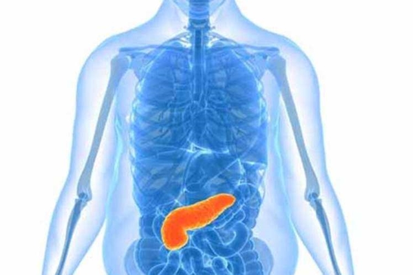 Dikkat! Bu belirtiler varsa pankreas kanseri olabilirsiniz!