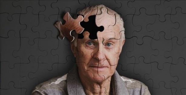 Dikkat! Bu beslenme tarzı, Alzheimer'ı hızlandırıyor